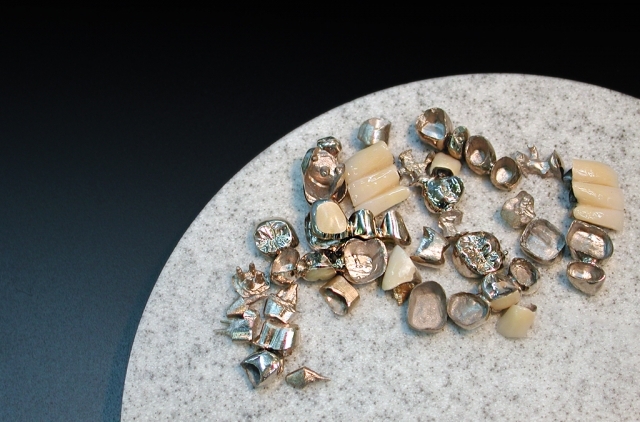 かぶせ物 かぶせ物